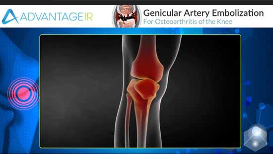 GAE Webinar Video Screen