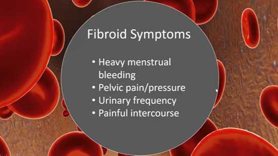 UFE Webinar Video Screen